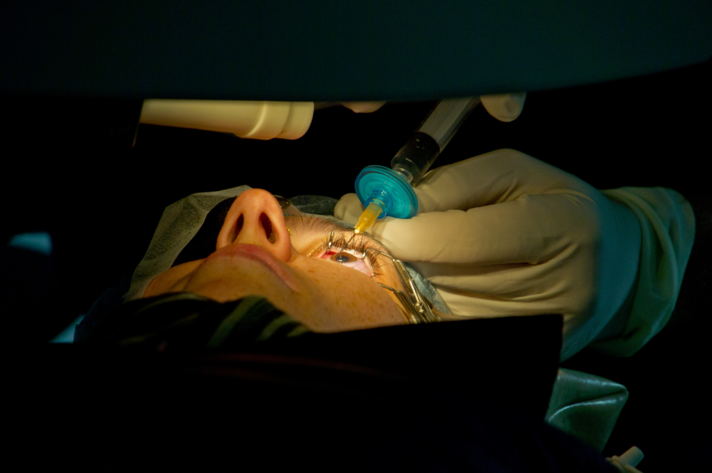 How LASIK Can Correct Vision Issues for People With Astigmatism and Nearsightedness